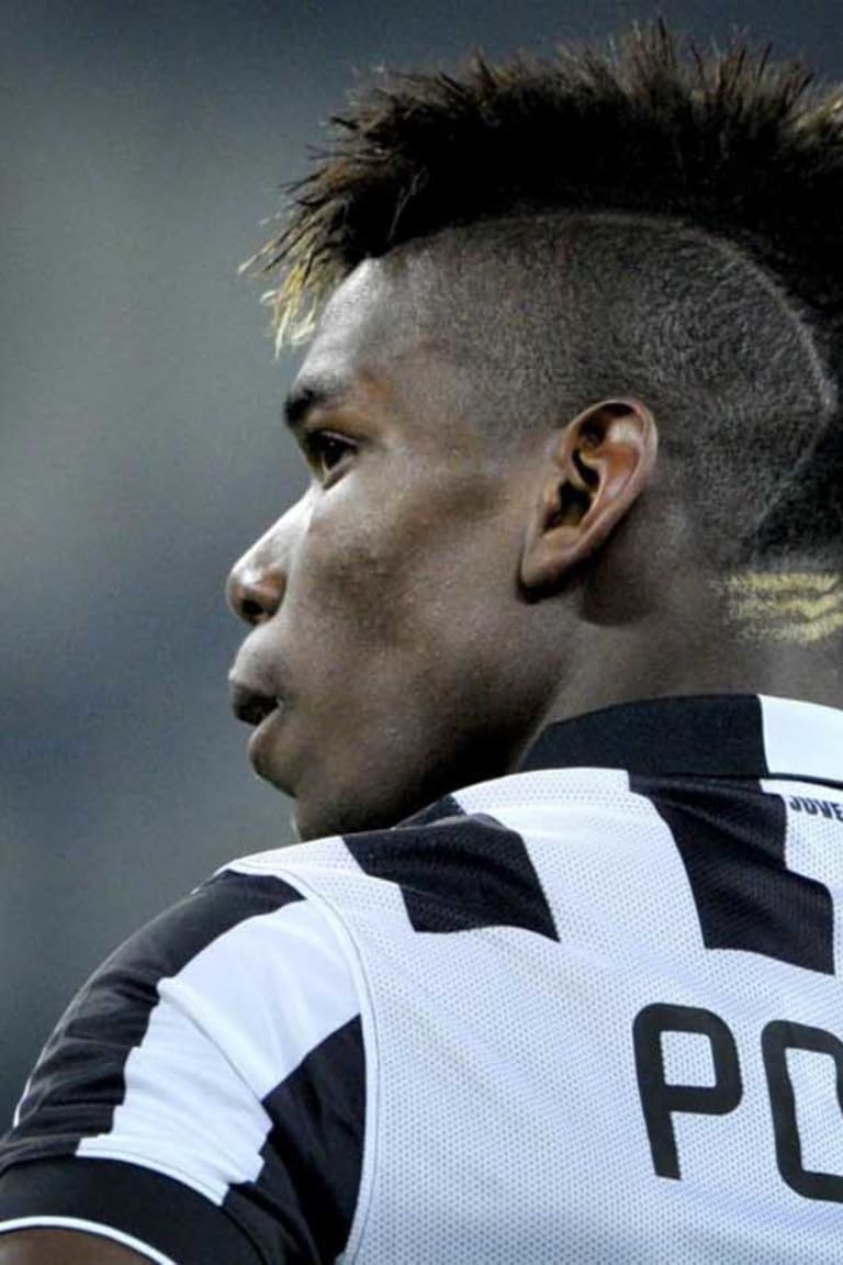 Le condizioni di Pogba