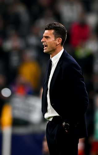 UCL | Juventus - Stoccarda, la conferenza stampa di Thiago Motta